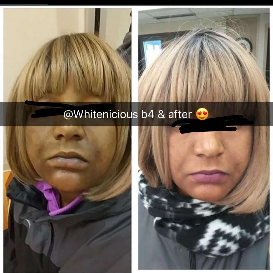 Ad by whitilicious.com